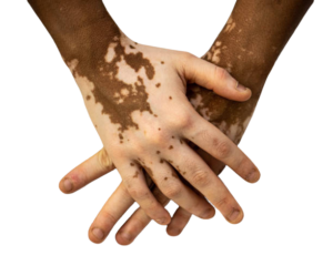 istockphoto 1403627696 612x612 (1) edited