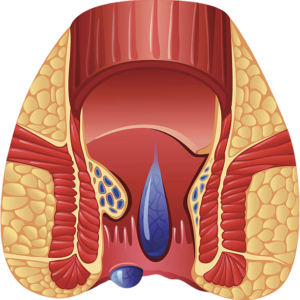 istockphoto 185640785 612x612 edited